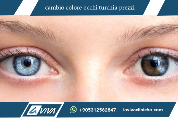 cambio colore occhi turchia