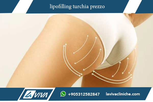 lipofilling turchia