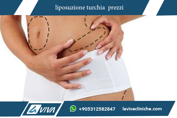 liposcultura turchia