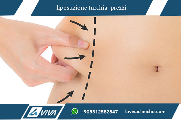 liposuzione addome turchia