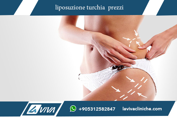 liposuzione in turchia prezzi