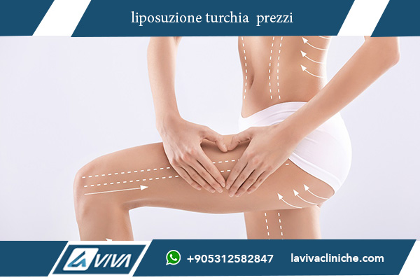 liposuzione istanbul prezzi