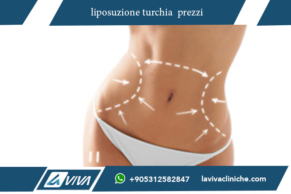 liposuzione turchia prezzi