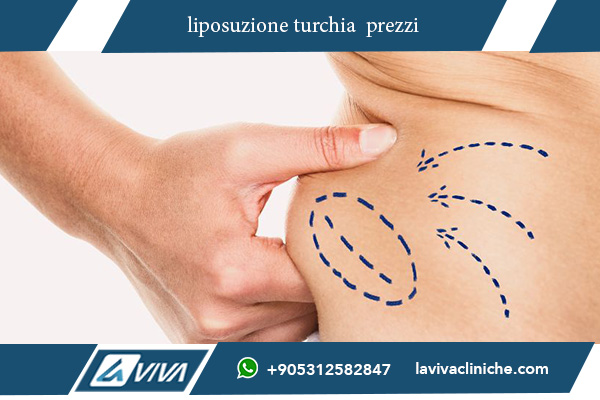 liposuzione turchia prezzo