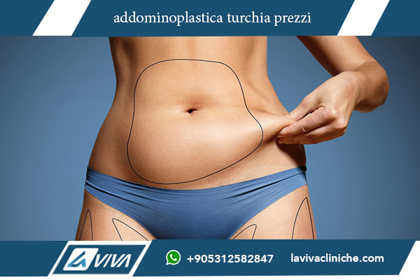 liposuzione turchia