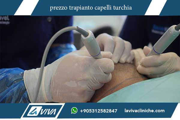 migliore clinica trapianto capelli turchia