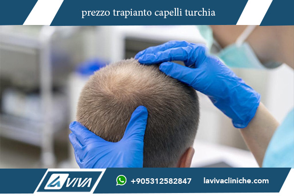 prezzo trapianto capelli turchia