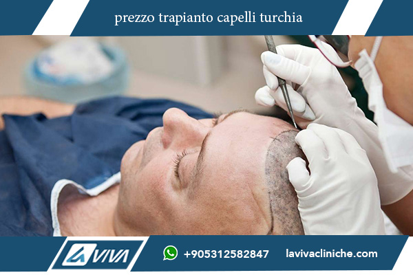 trapianto capelli turchia le iene