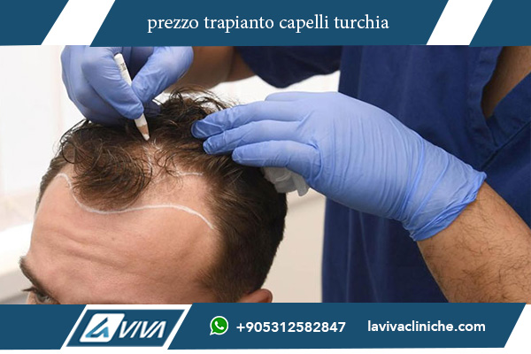 trapianto capelli turchia prezzi