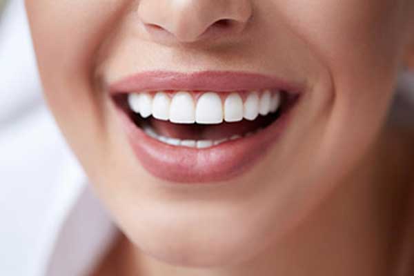 viaggio dentale in Turchia, impianti dentali in Turchia, faccette dentali in Turchia, turismo dentale Turchia, dentisti in Turchia, cliniche dentali Turchia, costi cure dentali Turchia, impianti dentali economici, sbiancamento dentale Turchia, All-on-4 Turchia, All-on-6 Turchia, denti perfetti in Turchia, trattamenti dentali all’estero, migliori cliniche dentali Turchia, prezzi faccette dentali Turchia