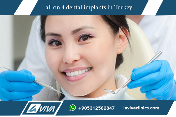 Faccette-Dentali-Istanbul