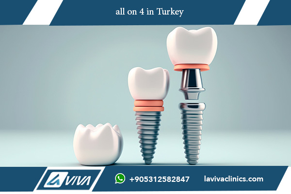 Implant Dentar Turcia
