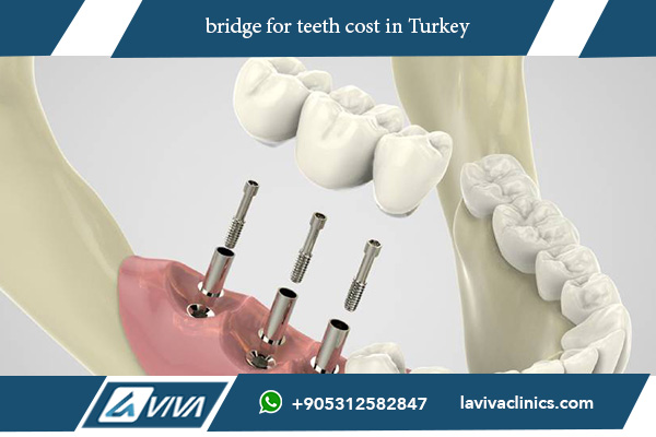 Clinici Dentare Istanbul