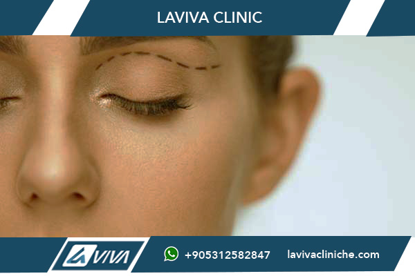 Blefaroplastica Turchia 2026