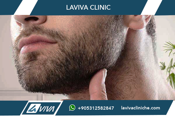 Trapianto Capelli Turchia 2026