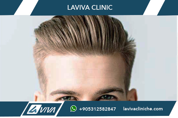 Trapianto Capelli Istanbul Prezzi 2025