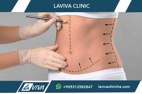 Chirurgia Estetica Economica Turchia