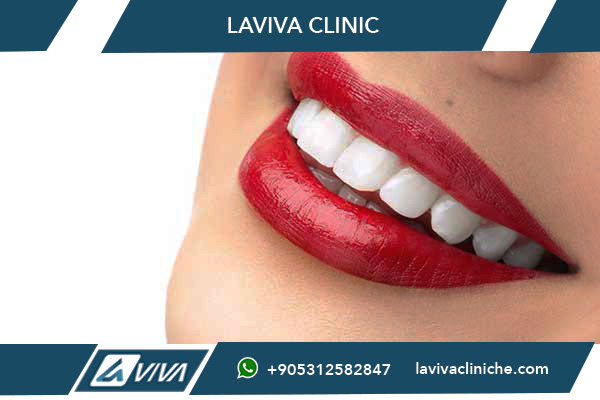 Clinica Dentale Affidabile Turchia: La Guida Definitiva 2025 per Italiani che Cercano Qualità e Risparmio