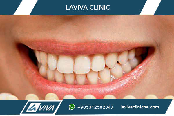 Cure Dentali Istanbul 2026: 20 Motivi per Scegliere le Migliori Cure Dentali a Istanbul (Prezzi, Cliniche e Recensioni ⭐⭐⭐⭐⭐)