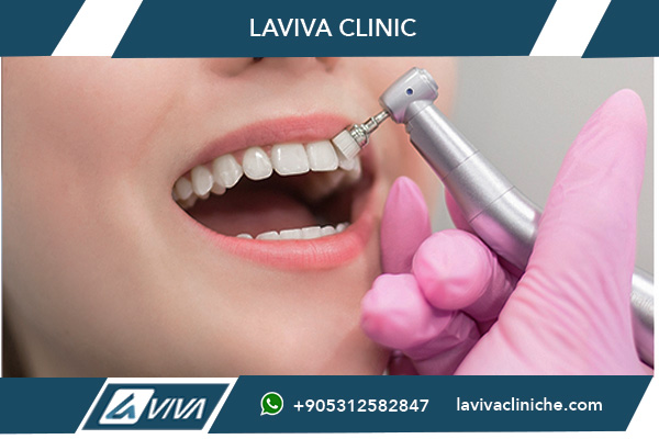 Viaggio Cure Dentali Turchia