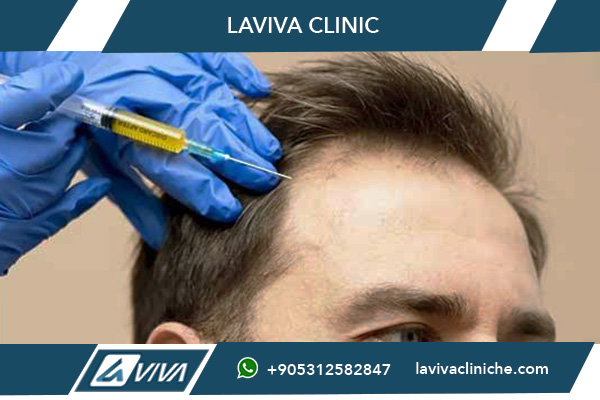 Trapianto Capelli Istanbul da Milano: La Guida Completa 2026