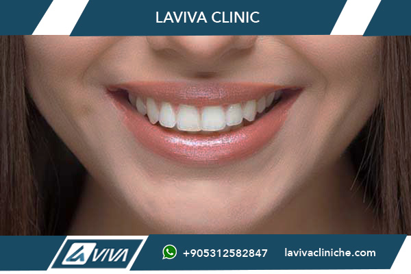 Dentista Turchia da Roma: La Guida Definitiva 2026 per un Sorriso Perfetto Risparmiando fino al 75%