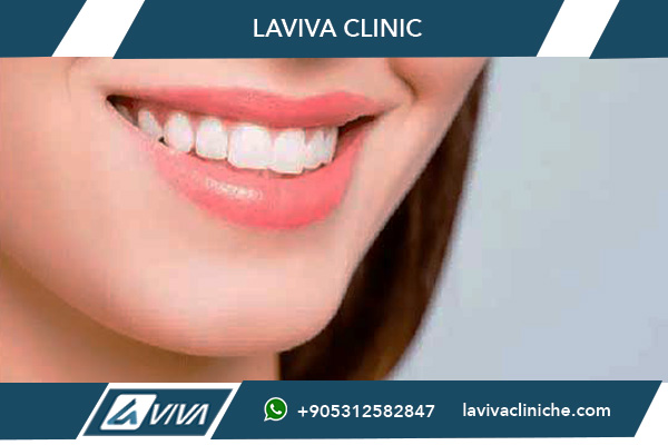 Cure Dentali Turchia da Torino: La Guida Definitiva 2026