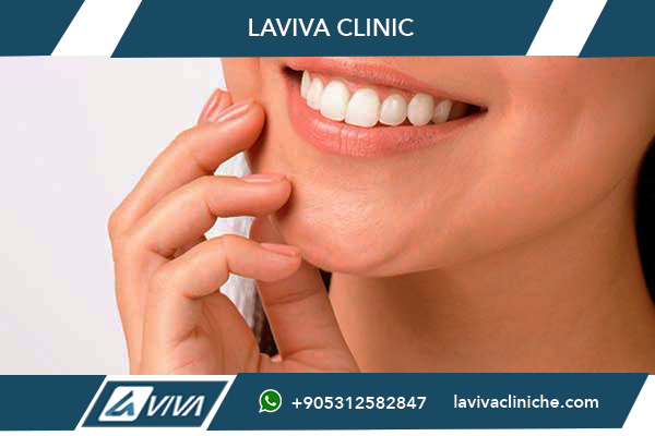 All-on-6 Turchia: La Guida Completa 2026 per il Tuo Nuovo Sorriso