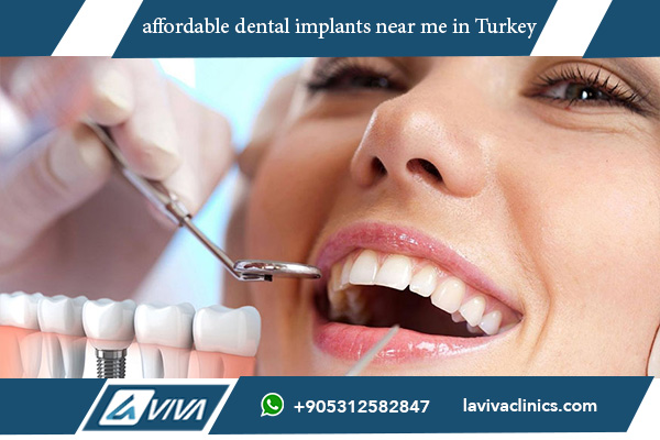 Clinica Turcia implant dentar